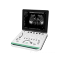 Type de Labtop Ultrasound portable